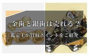 金歯と銀歯は売れるのか？鑑定士が答えます