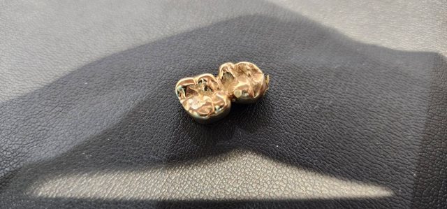 歯がついている金歯 18金 K18