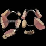 入れ歯 金歯 金 貴金属 歯科用合金 歯科用貴金属 金銀パラジウム合金