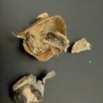 金歯　金　貴金属　歯科用貴金属　