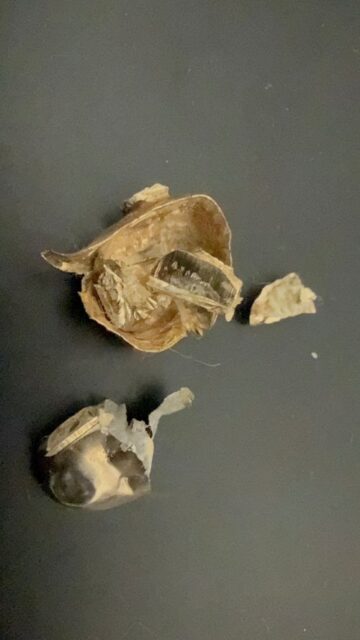 金歯 金 貴金属 歯科用貴金属